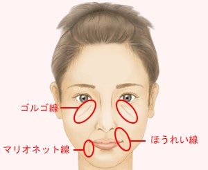 顔のたるみ ほうれい線の予防のために老けない秘訣とお手入れ法をチェック 日々の気になることあれこれ記録